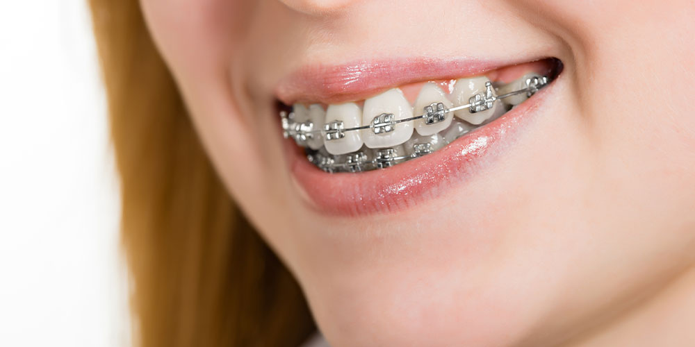 Perfecting Smiles with Advanced Ortho Solutions