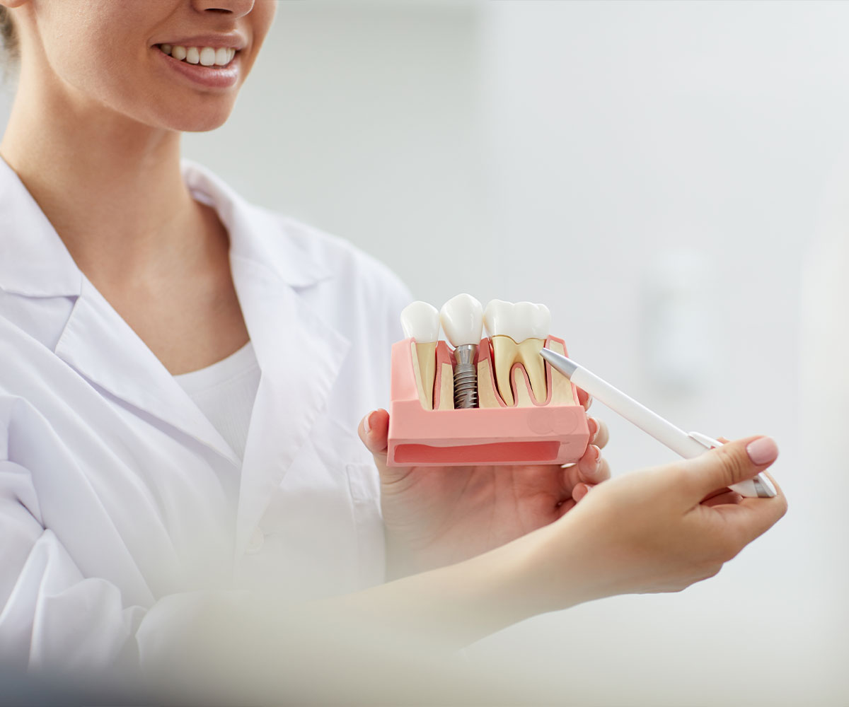 dental-implant-about-cover