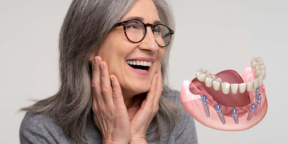 Enhanced stability for full-arch replacements.