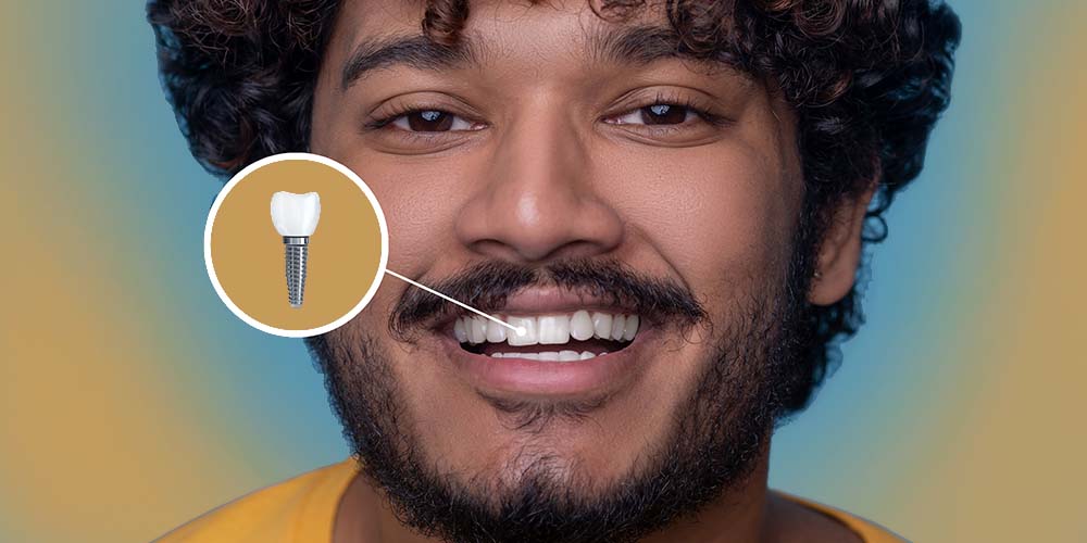 Replace missing teeth with lasting implants.