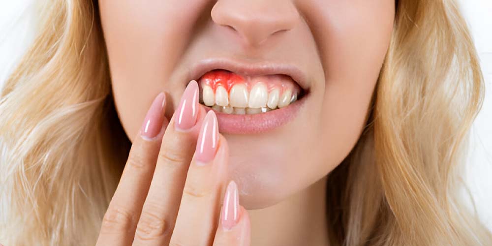 Treat gum infections, protect oral health.