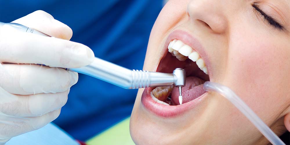 Deep clean for smoother, brighter teeth.