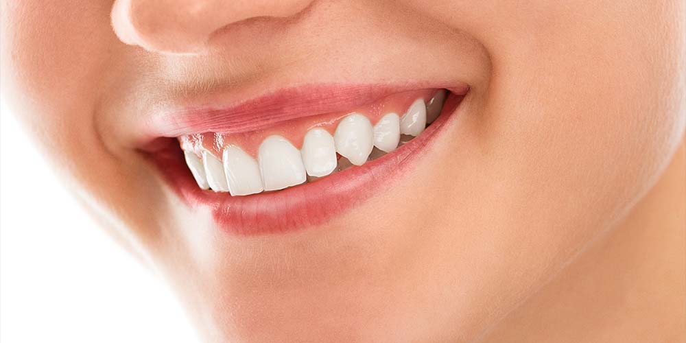 Brighten teeth for a radiant smile.