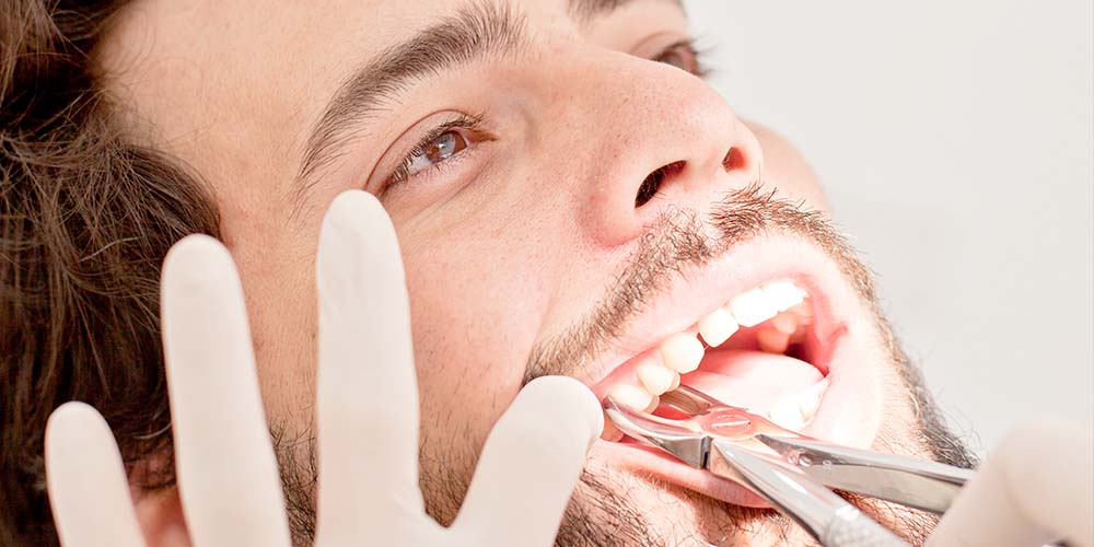 Gentle removal for improved oral health.