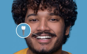 influencer-dental-implant-in-dubai influencer-dental-implant-in-dubai