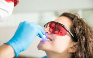 influencer-teeth-whitening-in-dubai influencer-teeth-whitening-in-dubai