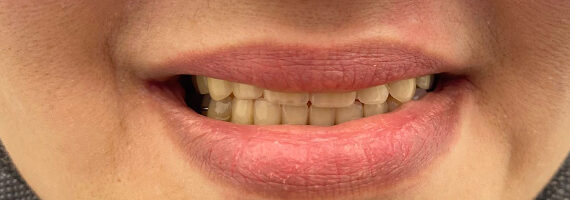after-dental