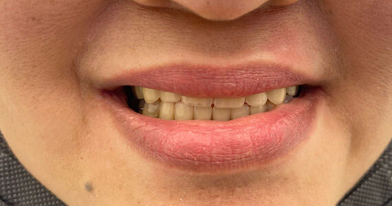 after-dental