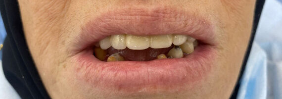 before-dental-11