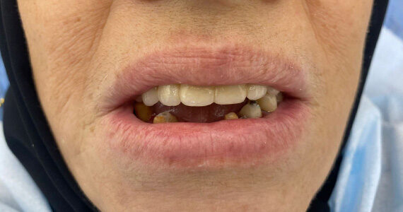 before-dental-11