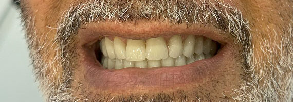 dental-after-10