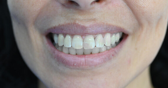 dental-after 2