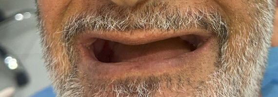dental-before-10