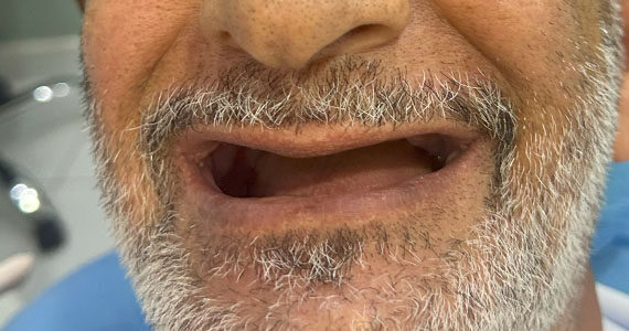 dental-before-10