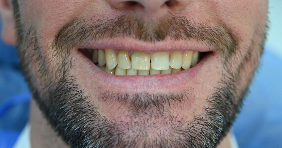 dental-before