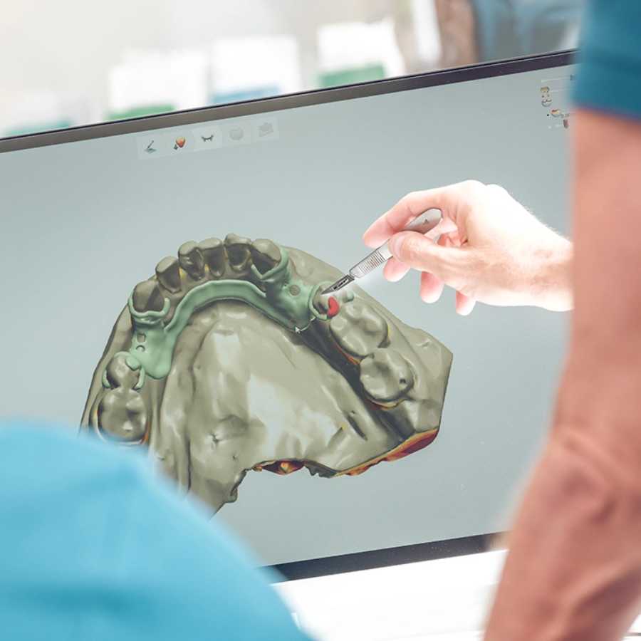 3d-guided-dental-implants-in-dubai