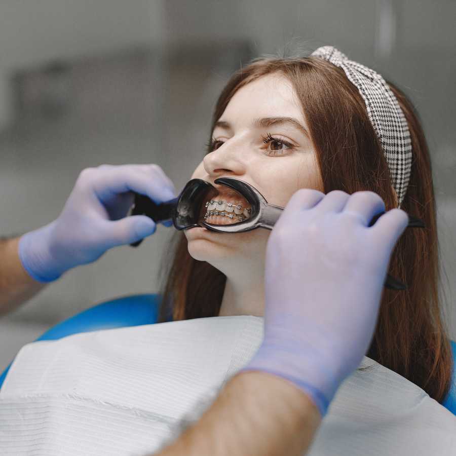 ceramic-braces-in-dubai