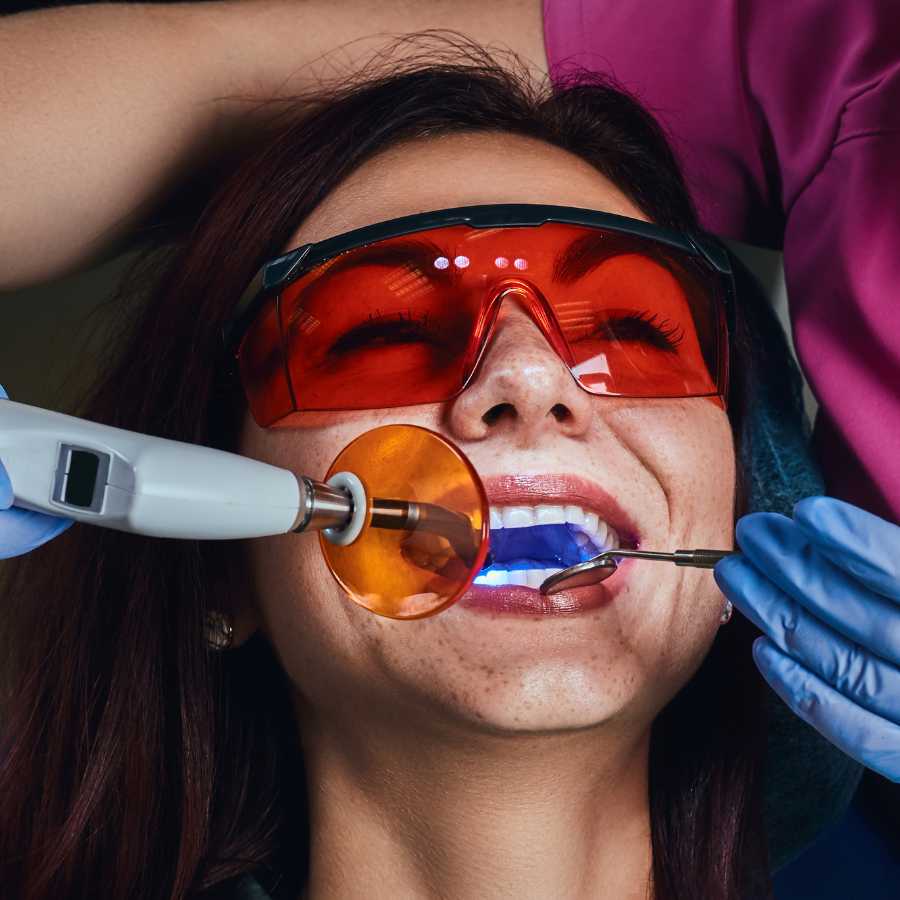 fluoride-therapy-treatment-in-dubai