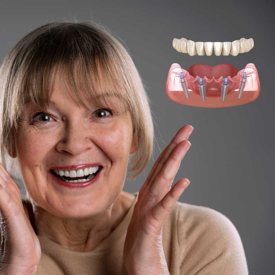 all-on-4-dental-implants-in-dubai