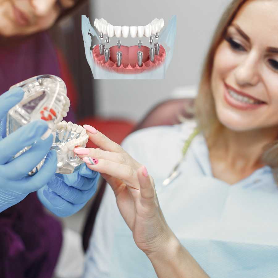all-on-6-dental-implant-in-dubai