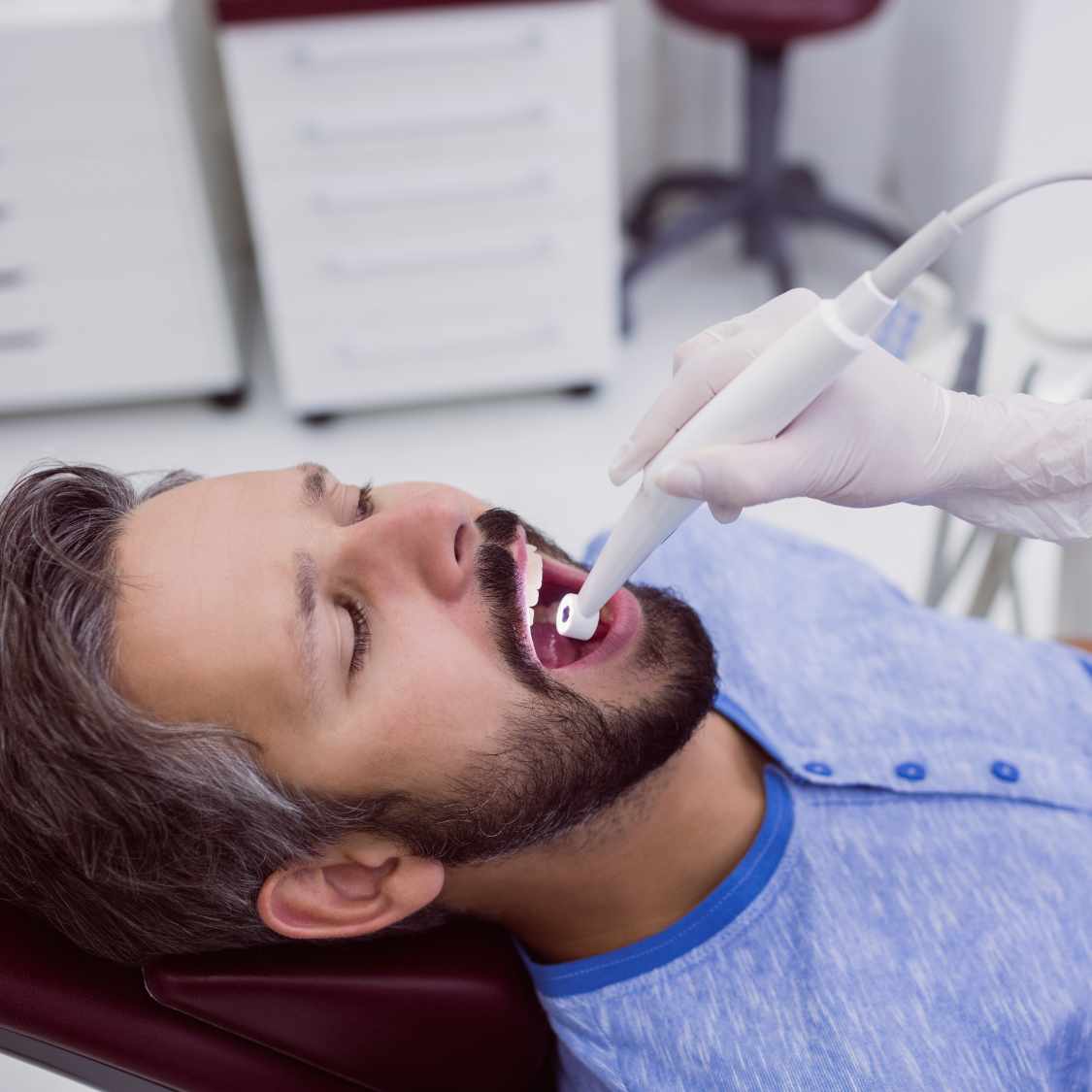 best-teeth-filling-in-dubai