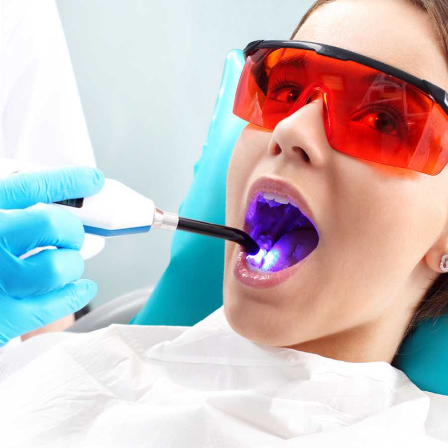 dental-sealants-in-dubai