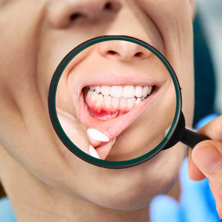 gum-disease-treatment-in-dubai